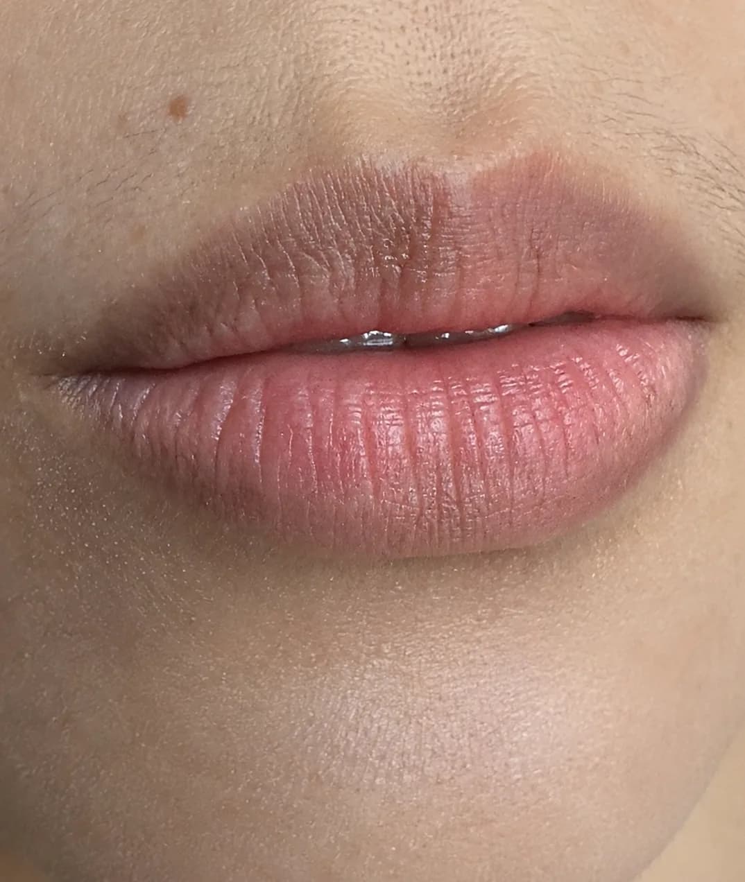 Boca cerrada con el labio superior de tono desparejo, más oscuro de un lado que del otro, y el borde poco marcado contra la piel.